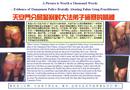 Published on 2/15/2001 鷨ͼƬѪֹ֤ѧԱܵĿ˺
