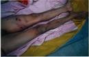 Published on 10/30/2000 法轮功,图片：大法弟子刘玉风被殴打致死的铁证
