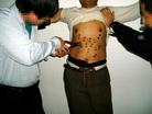 Published on 3/20/2005 		黑龙江哈尔滨市长林子劳教所迫害大法弟子的酷刑（图）
