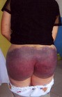 Published on 8/12/2009 法轮大法明慧网 - 善良村妇惨遭毒打　丈夫被判十三年（图）