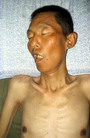 栾福生 (河北石家庄) 于2007年4月8日被山西省晋中监狱迫害致死，终年56岁。图为栾福生的遗体