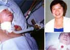 Published on 2000 32ŮʿǱ̴ѧĽʦ2000619գԺ԰ʱ⾯вںϵġ塢ھ׵ڲ֪ͨ͵λ£콫͵ҽԺԾŮʿھµʹĥԩȥ. <br>й