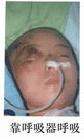 迟春霞(黑龙江)于2002年1月3日，被密山市政保科孟庆启、杜永山迫害致生命垂危