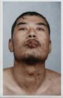 吕大伟(辽宁)被朝阳市教养院、朝阳县公安局，凌源市国保大队等恶警用电棍电击、烧伤的见证