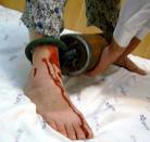 		������ʾ�������ͽ������󷨵��ӹ�ʺ������ˢ��Ƥ����ͼ��
