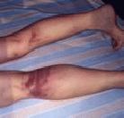 Published on 4/30/2001 ͼ�ģ����ںӱ����ݹ��������ܿ�����ĥ�ľ���

